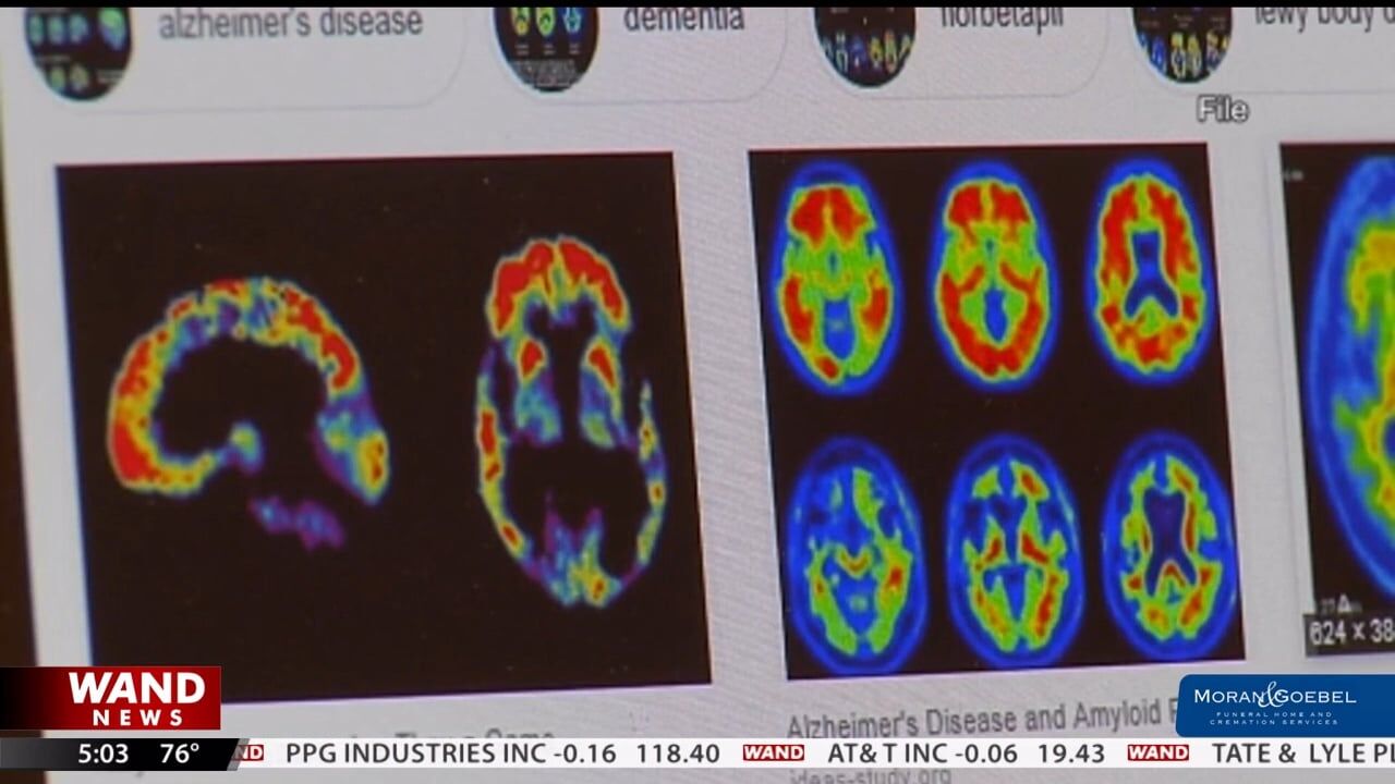 New IL law requires state employee health insurance coverage for Alzheimer's treatment